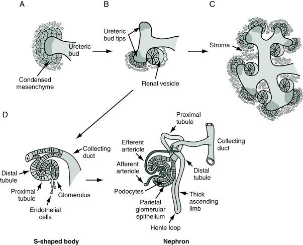 Fig. 15.1, Stages of nephrogenesis. (A) Induction of the metanephric mesenchyme by the ureteric bud promotes aggregation of condensed mesenchyme around the tip of the ureteric bud. (B) Renal vesicles form as the mesenchyme transitions to epithelium. (C) Fusion of renal vesicles occurs with the collecting ducts. (D) A cleft forms in the renal vesicle, giving rise to the comma-shaped body and with formation of a second proximal cleft the S-shaped body forms. Invasion of the proximal cleft by angioblasts leads to formation of the glomerulus.