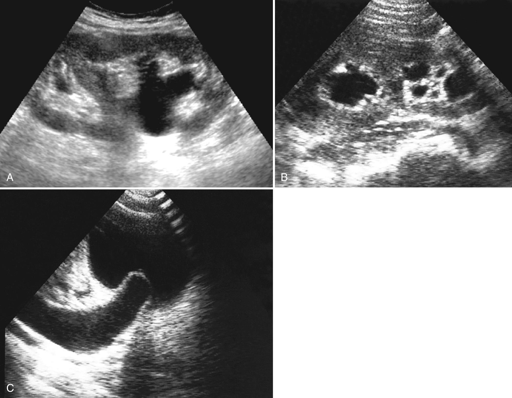 FIG. 9.13, Duplex Collecting System.