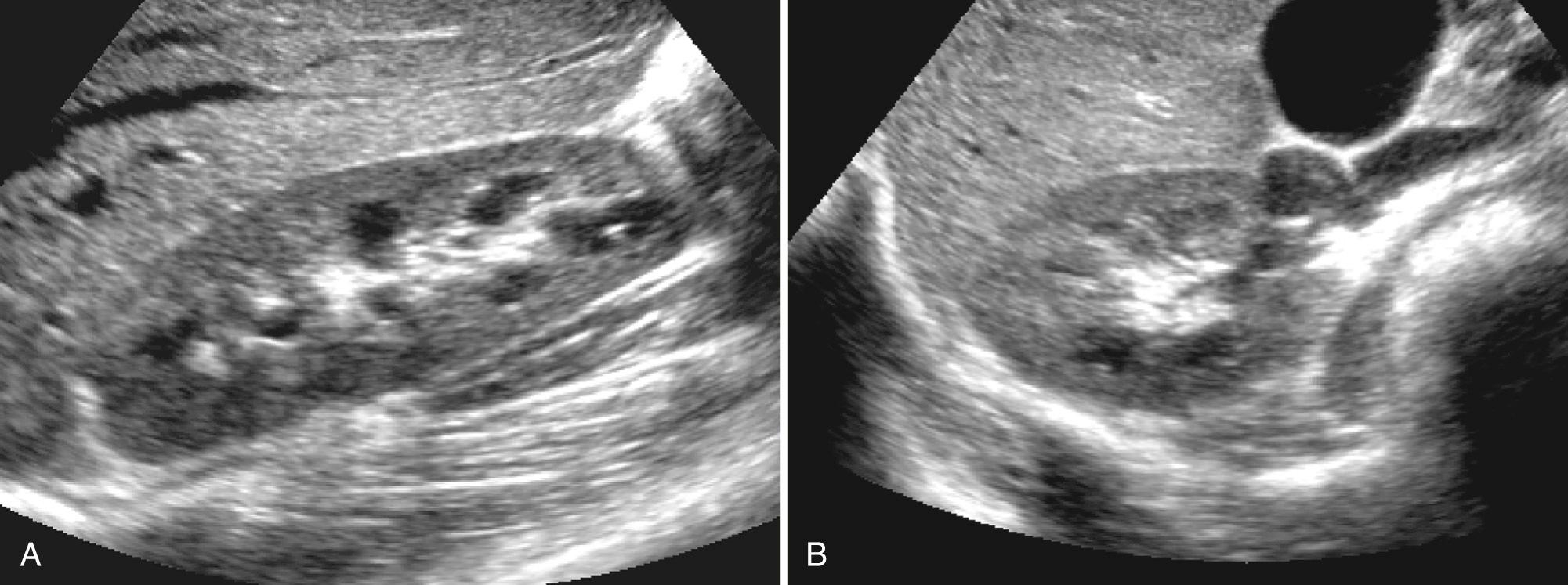 FIG. 9.4, Normal Kidney.