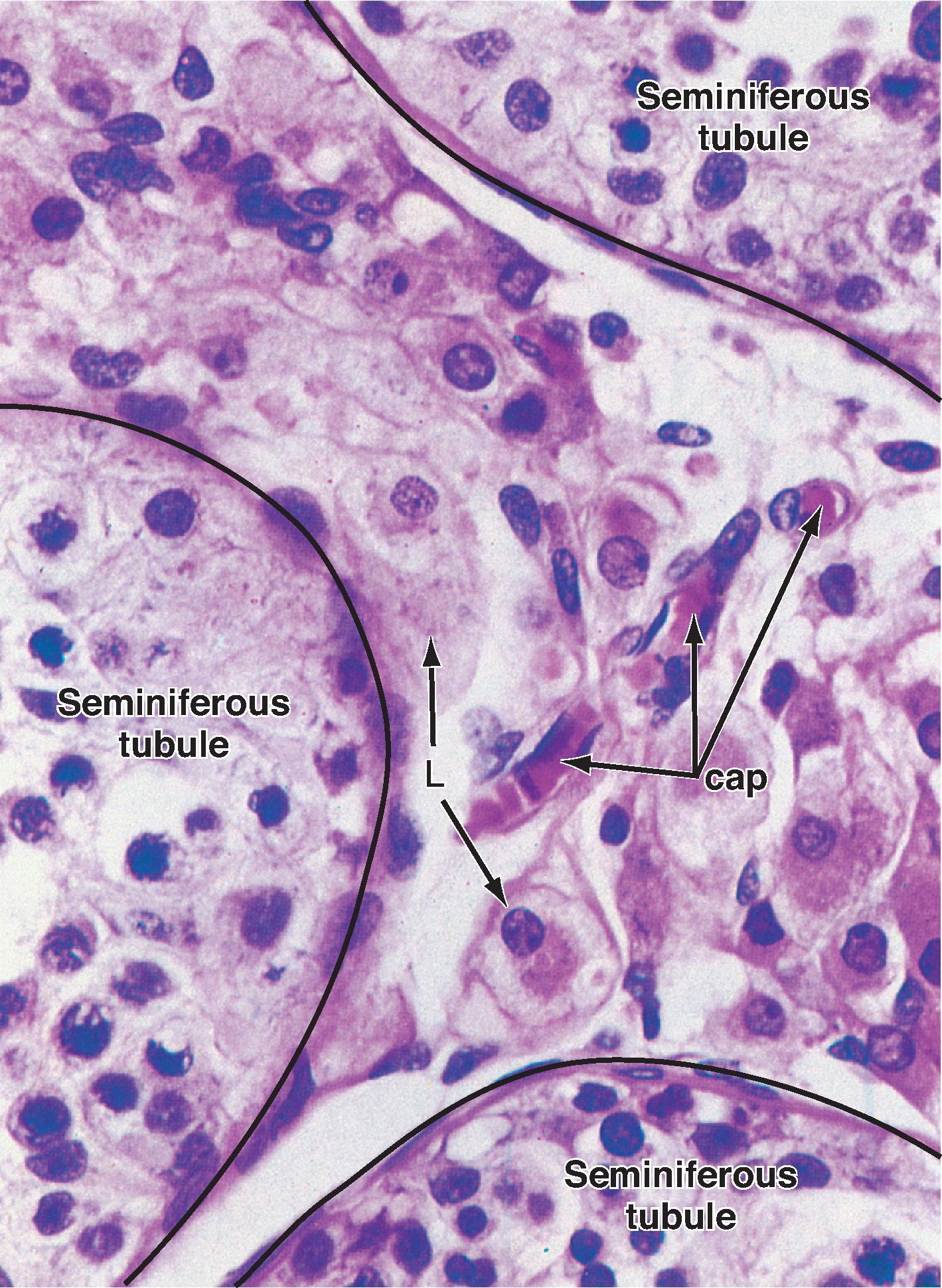 Fig. 44.7, Histology of the peritubular space (between three seminiferous tubules) containing Leydig cells (L) and richly vascularized by peritubular capillaries (cap) .