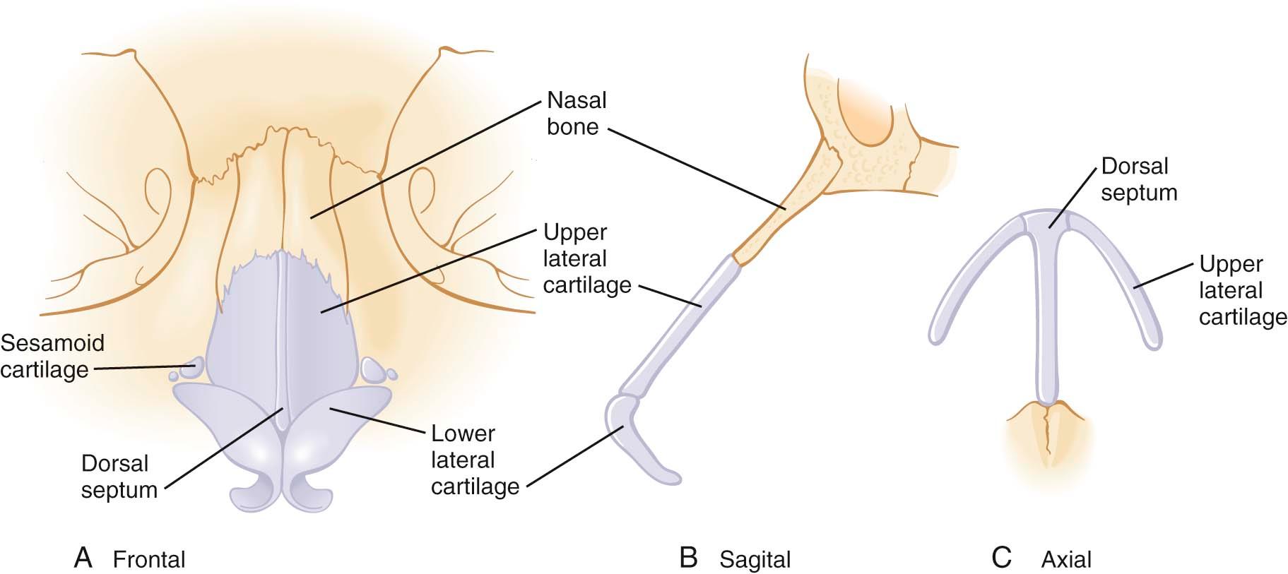 Figure 12-1, Middle nasal vault anatomy.