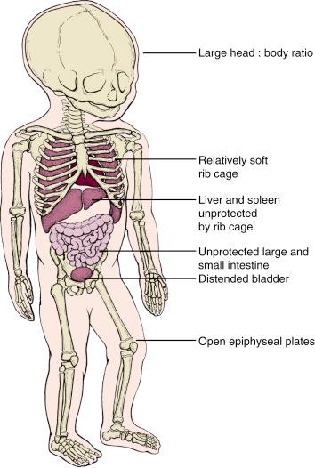 Fig. 5.2, Anatomic differences predispose a child to injuries different from those of an adult. These differences include a disproportionately large head, pliable rib cage with exposed liver and spleen below its margin, unprotected large and small bowel, distended bladder above the pelvic brim, and open physes.