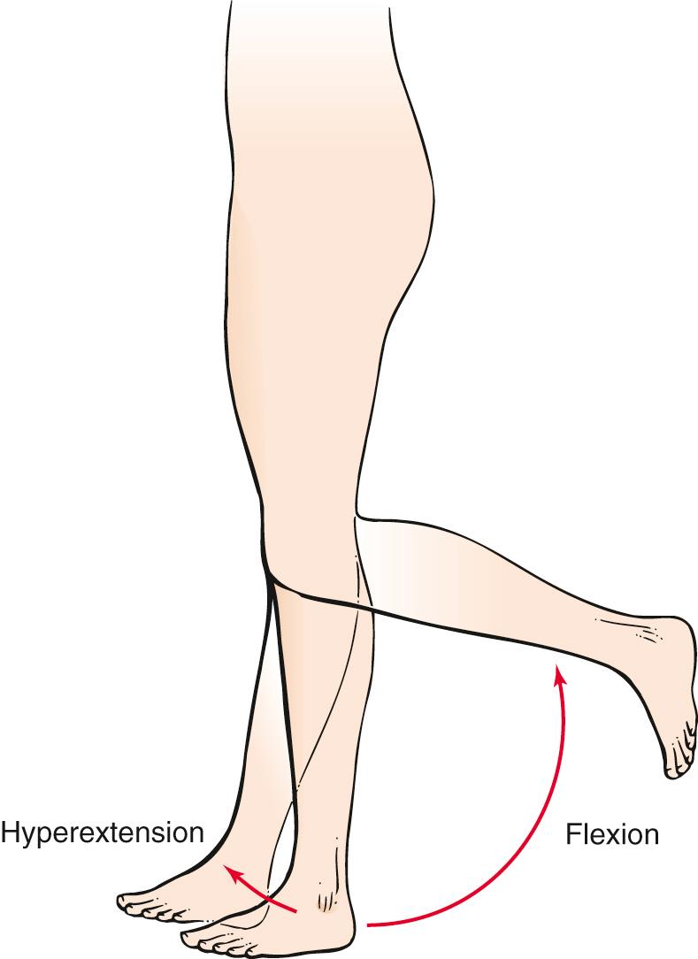 Fig. 20.16, Range of Motion at the Knee Joint: Flexion and Hyperextension.