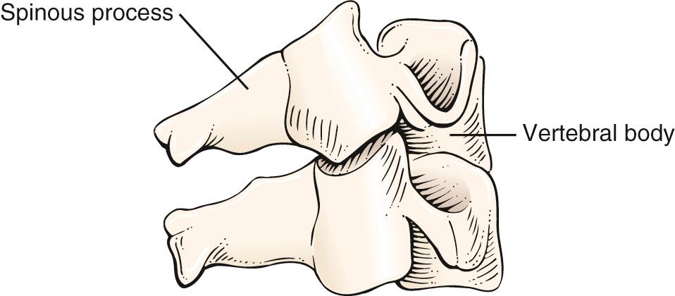 Fig. 20.19, Anatomy of the Cervical Spine.