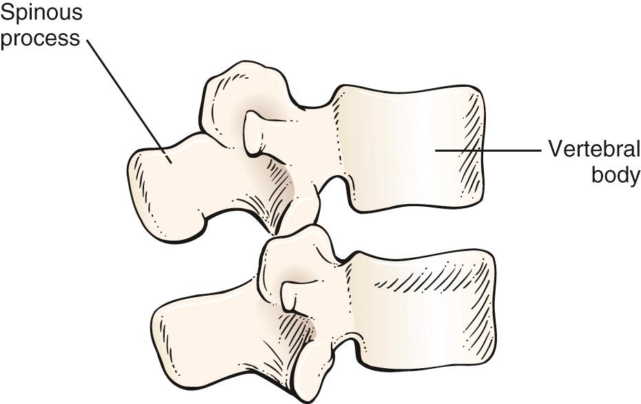 Fig. 20.21, Anatomy of the Lumbar Spine.