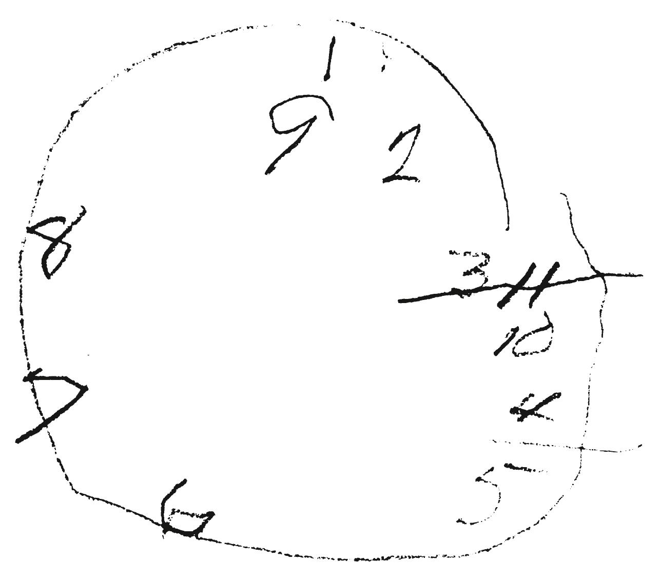 Fig. 33.3, A clock face drawn by a patient with a parietal lobe lesion.