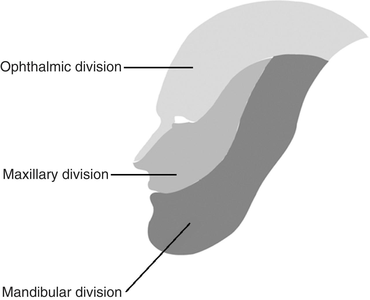 Fig. 17.1, Divisions of the trigeminal nerve.