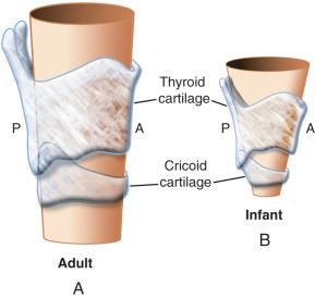 FIGURE 14.6, Configuration of the larynx of an adult (A) and an infant (B) . Notice that both larynxes are somewhat funnel shaped, but this shape is exaggerated in the infant and toddler. The adult laryngeal structures are of such size that most endotracheal tubes pass easily into the trachea. In infants and toddlers, it is common for the endotracheal tube (ETT) to pass easily through the vocal cords but to become snug at the level of the nondistensible cricoid cartilage. Concern for causing edema at this point resulted in the classic teaching that uncuffed ETTs should be used in young children (see text for more details). A, anterior; P, posterior.