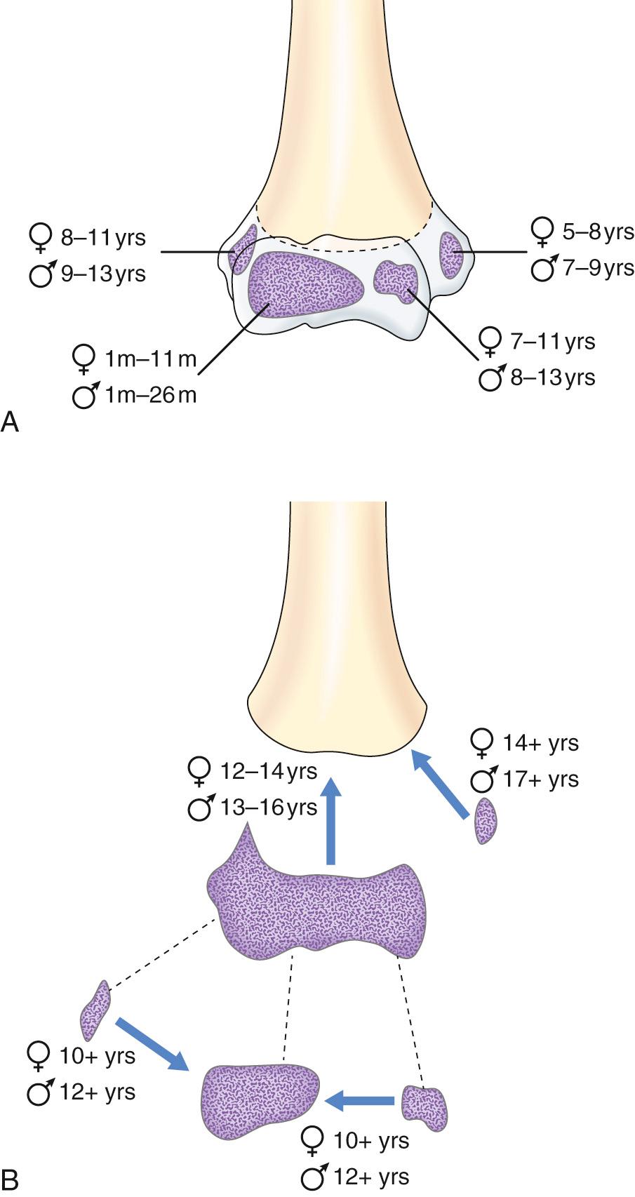 FIG 25.1, (A) Average age range of distal humerus ossification center appearance in boys and girls. (B) Average age at which these ossification centers coalesce and fuse by sex.