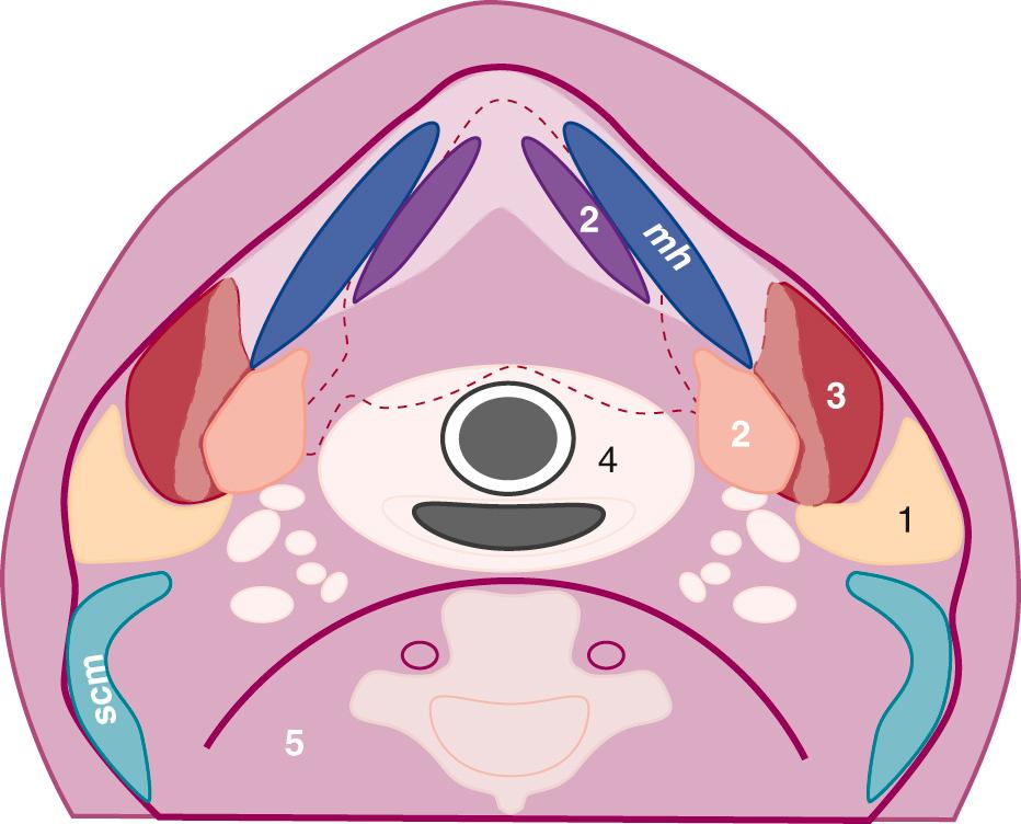 FIG. 48.3, Deep Cervical Fascial Layers of Suprahyoid Neck, Axial Image.