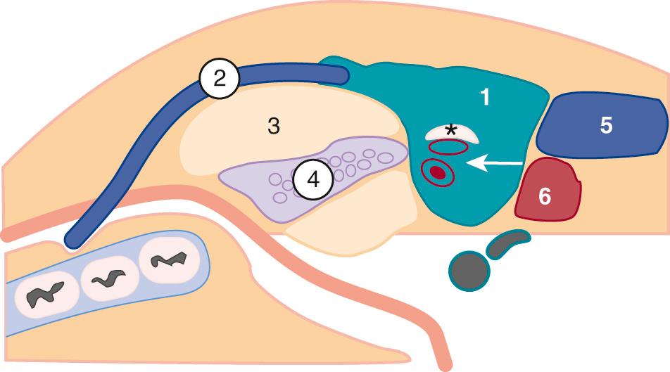 FIG. 48.4, Diagram of Parotid Space.