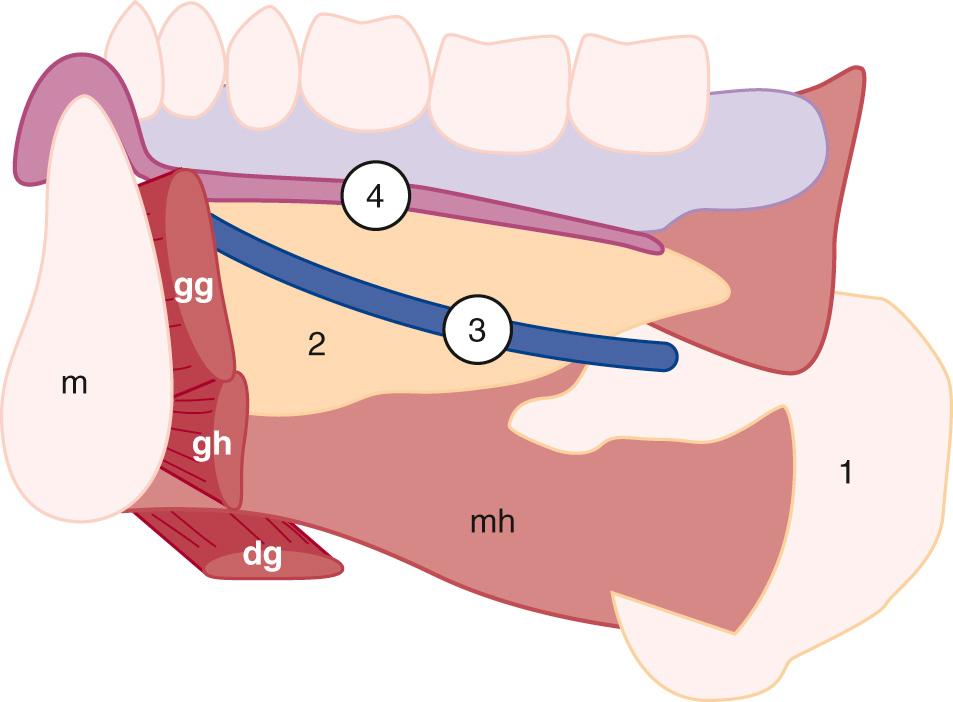 FIG. 48.6, Normal Submandibular Space.