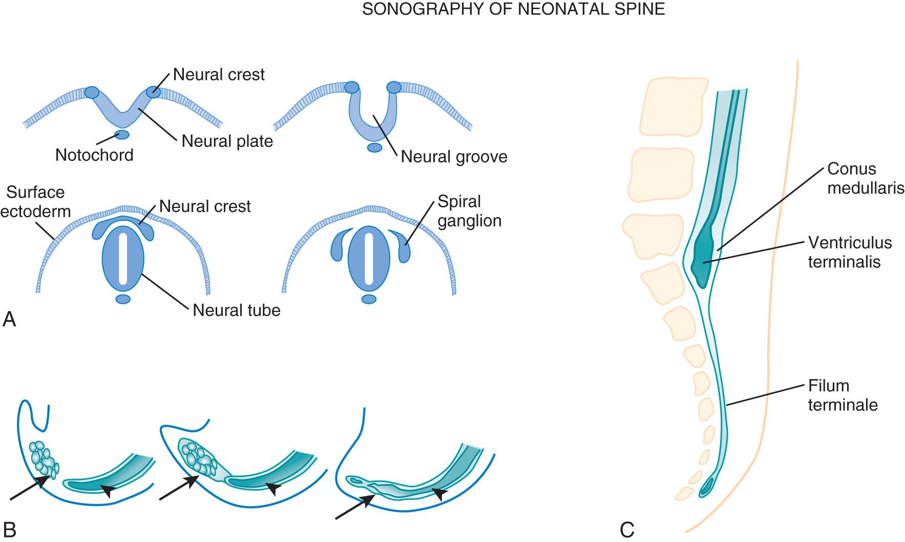 FIG. 49.2, Three Stages of Spinal Cord Development.