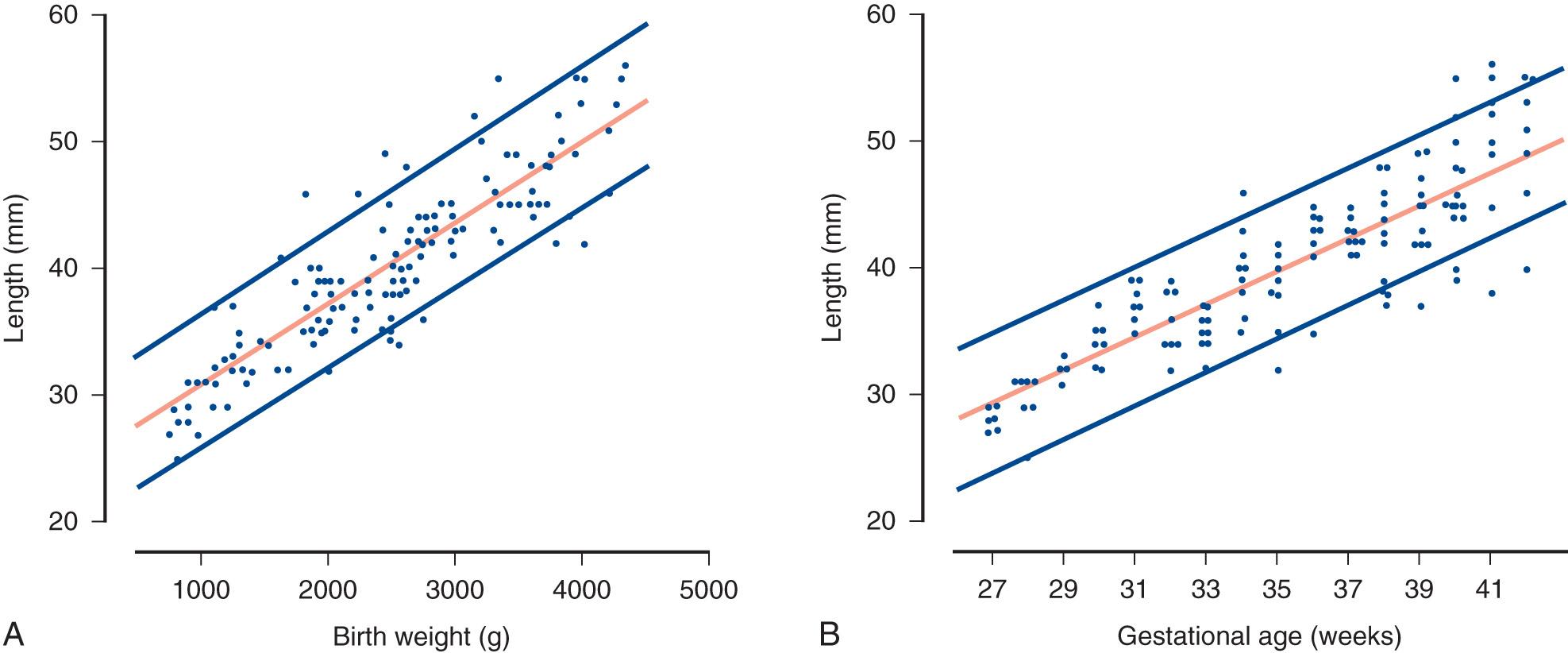 FIG. 52.3, Kidney Length Versus Birth Weight (A) and Gestational Age (B).