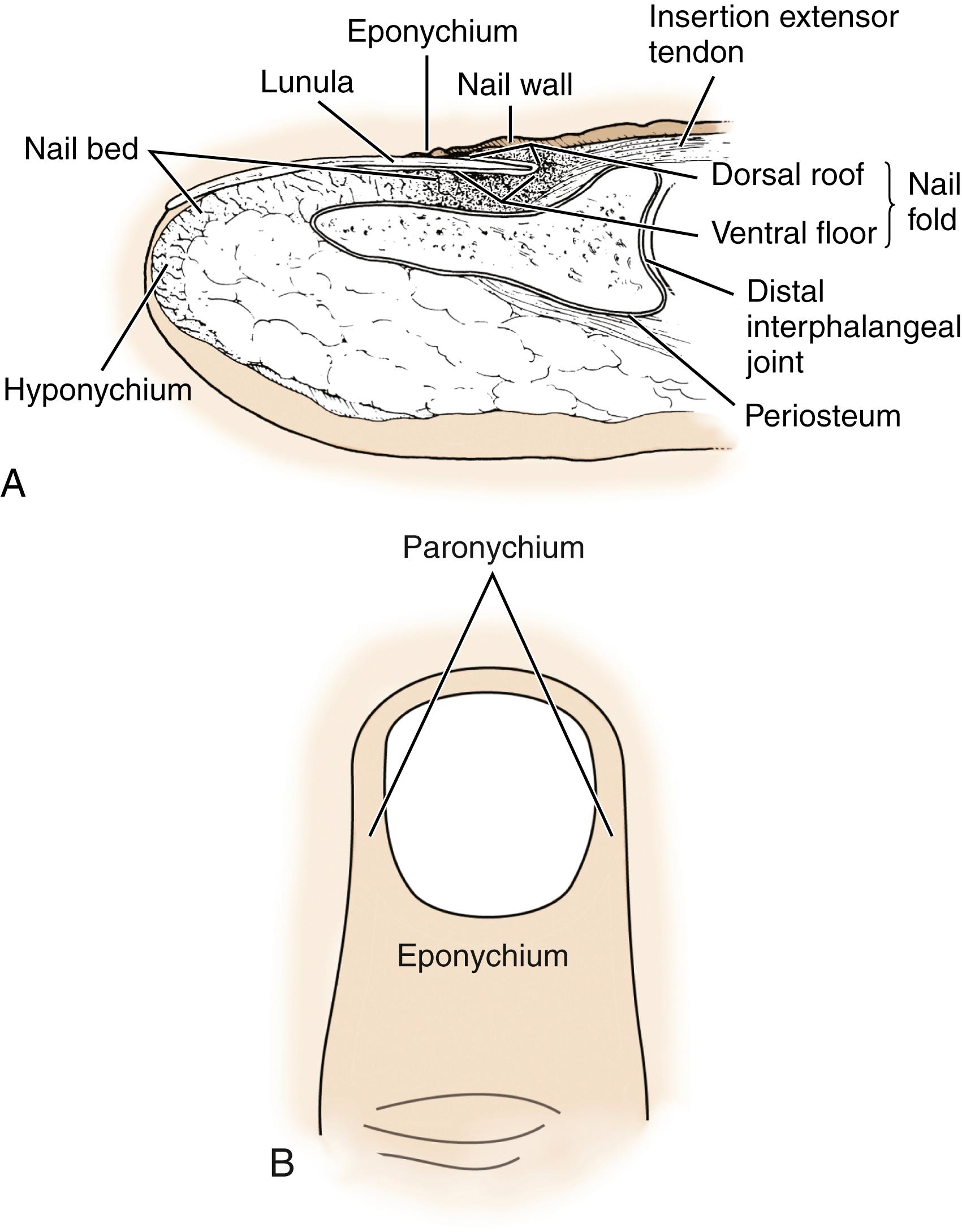 Fig. 9.1, A, Anatomy of the nail bed shown in sagittal section. B, The perionychium includes the paronychium, eponychium, hyponychium, and nail bed.