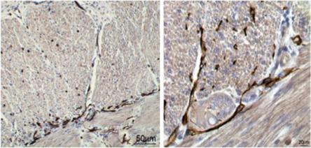 Fig. 13.1, Human colon ICC visualized using Kit antibodies. ICC surround the myenteric ganglia (ICC-MP), follow along septa (ICC-IM) and are dispersed in the circular (top) and longitudinal muscle (ICC-IM). The staining procedures are similar to those described in Ref. 35 .