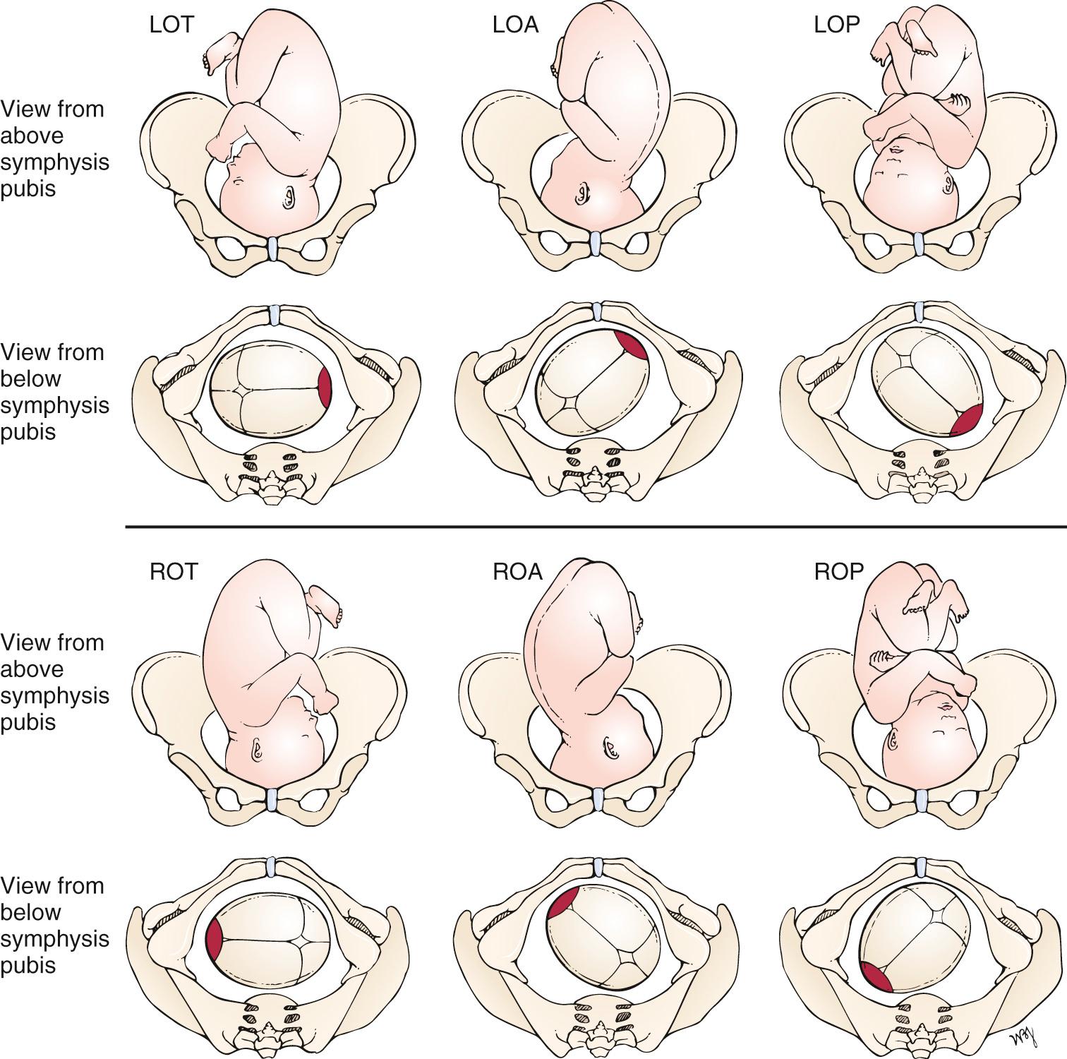 Fig. 23.4, Common Clinical Vertex Positions.