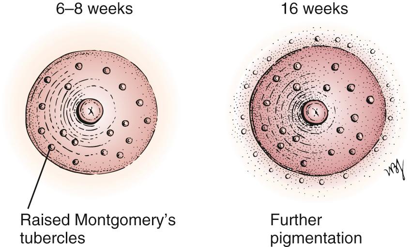 Fig. 23.7, Nipple and Areola Changes During Pregnancy.