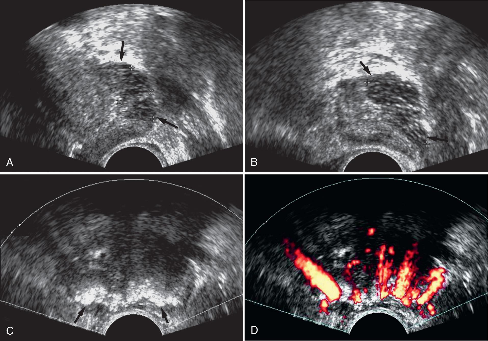 FIG. 10.7, Normal Anatomic Variants.