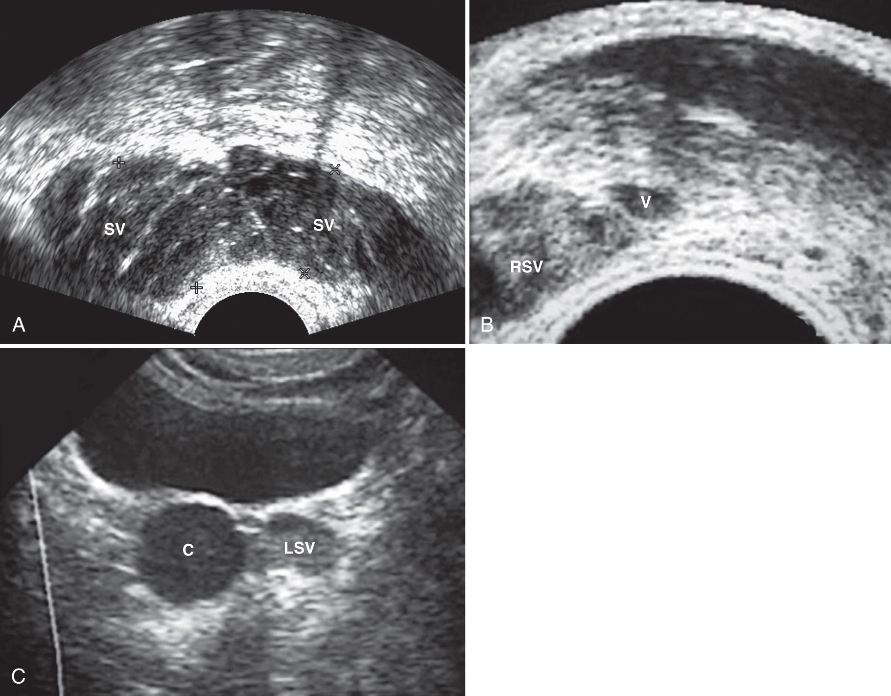 FIG. 10.10, Infertility.