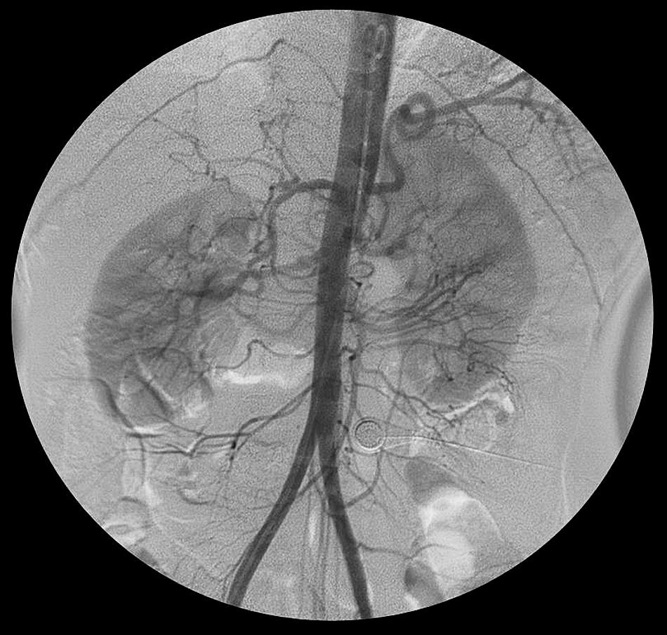 FIG. 12.1, Abdominal Aorta Anatomy.