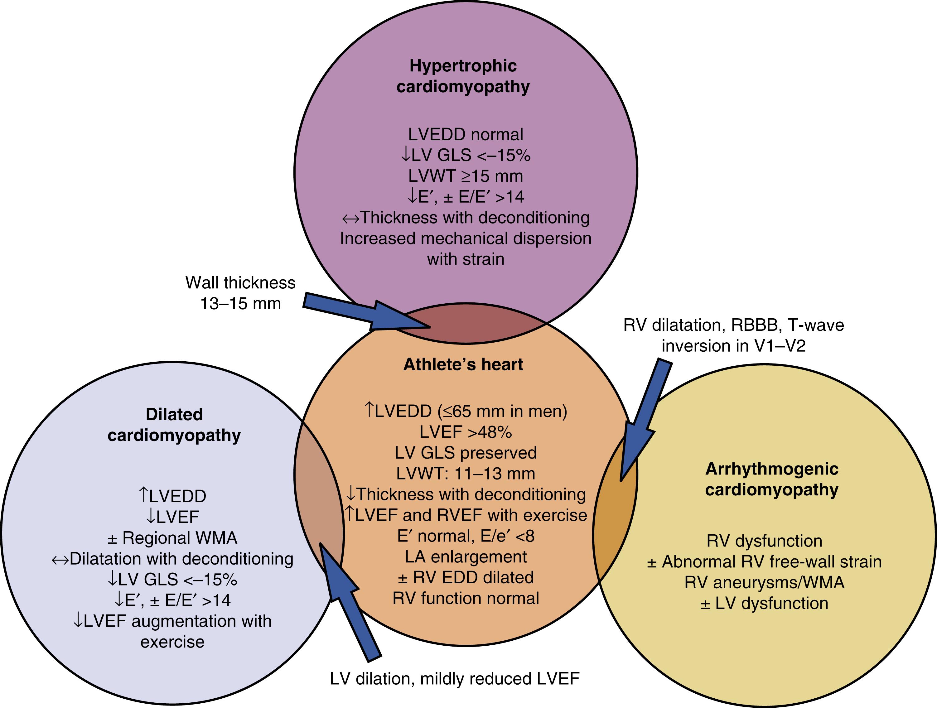 Figure 64.2, Echocardiographic features demonstrating the salient features and “gray zones” between athlete’s heart and other overlapping cardiomyopathy syndromes. EDD, End-diastolic diameter; GLS, global longitudinal strain; LA, left atrial; LV, left ventricular; LVEDD, left ventricular end-diastolic diameter; LVEF, left ventricular ejection fraction; LVWT, left ventricular wall thickness; RBBB, right bundle branch block; RV, right ventricular; WMA, wall motion abnormality.