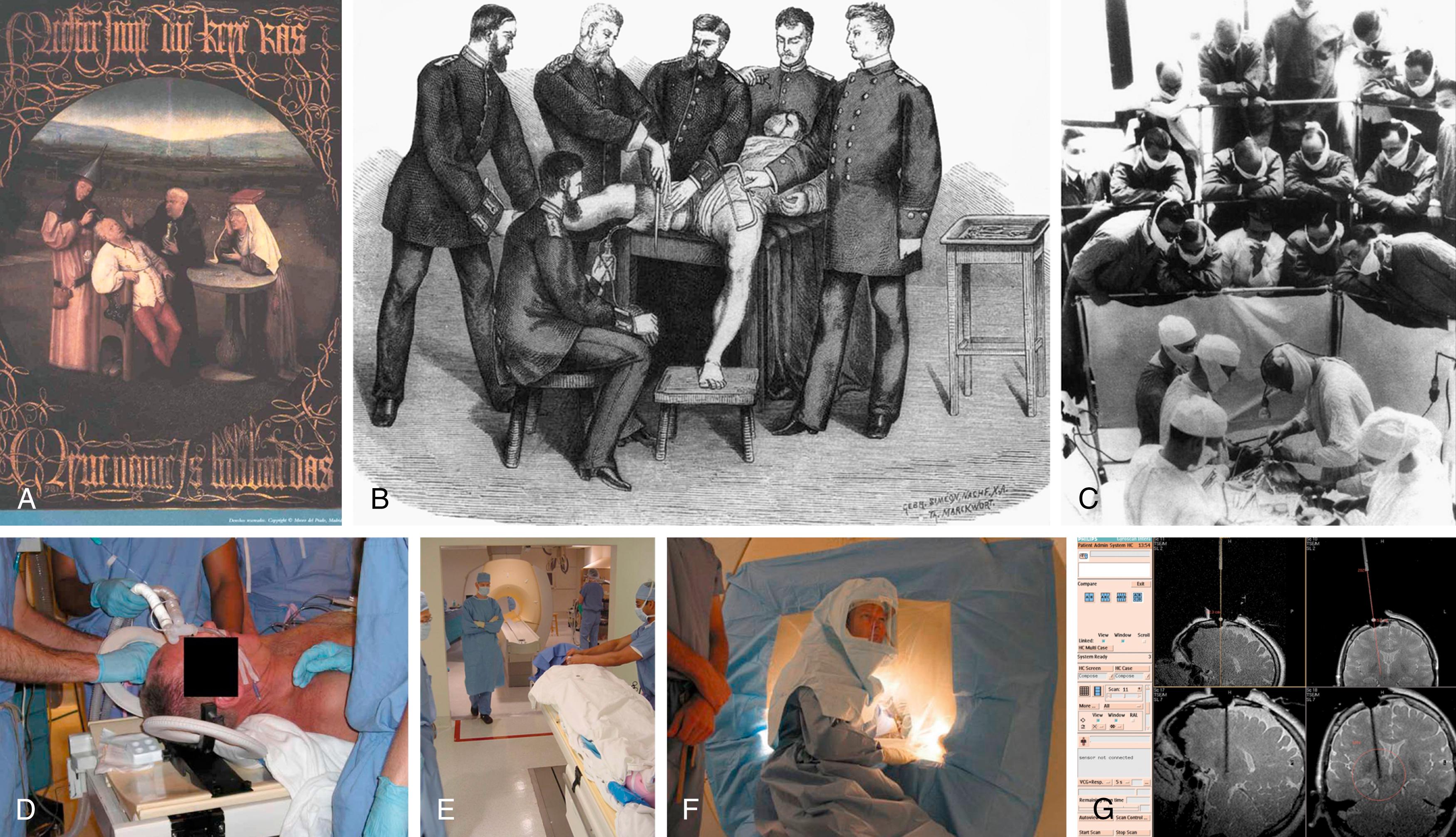 Fig. 1.1, Changing scope and settings of anesthesia and perioperative medicine.