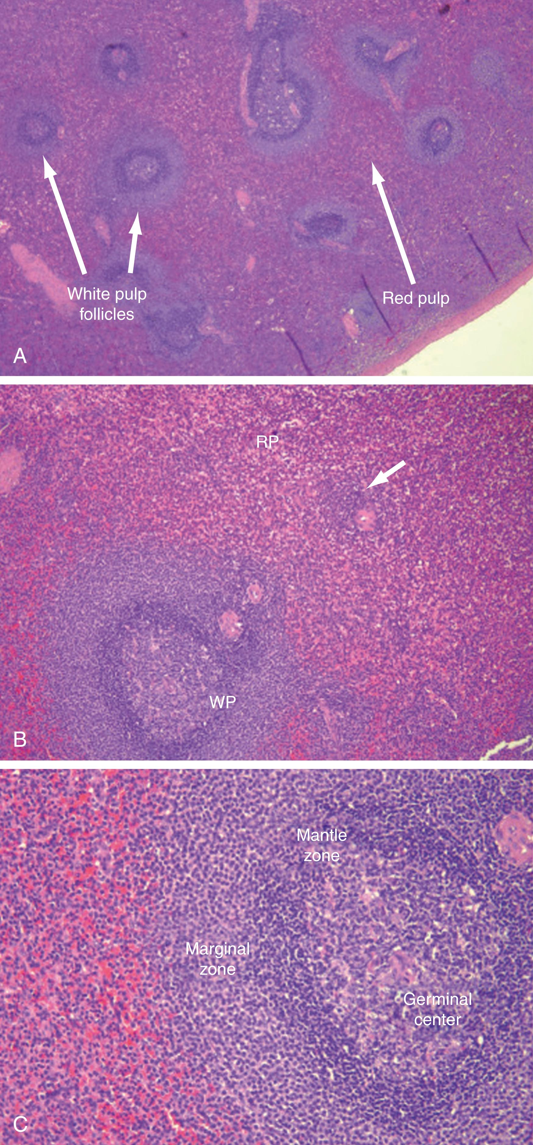 Fig. 57.5, Normal human spleen on hematoxylin-eosin staining. (A) Low-power photomicrograph showing relationship and relative proportions of red and white pulp. (B) Medium-power photomicrograph ( arrow indicates periarterial lymphoid sheath). (C) High-power photomicrograph showing detailed secondary follicle architecture. (From Pernar LIM, Tavakkoli A. Anatomy and physiology of the spleen. In: Yeo CJ, eds. Shackelford’s surgery of the alimentary tract . 8 th ed. Philadelphia, PA: Elsevier; 2019:1595.). RP, Red pulp; WP, white pulp (secondary follicle).