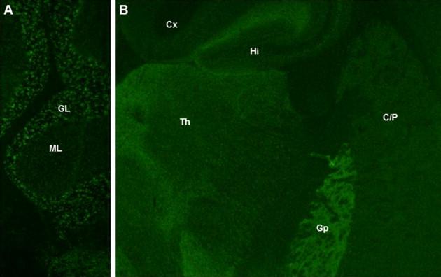 Figure 11.1, GAD65-IgG detected by indirect immunofluorescence on mouse cerebellum, A , and other brain regions (coronal section), B. Characteristic synaptic staining pattern is most prominent in the granular layer (GL) of cerebellum and globus pallidus (Gp). Less intensely stained regions include molecular layer of cerebellum (ML), thalamus (Th), caudate and putamen (C/P), hippocampus (Hi) and cerebral cortex (Cx).