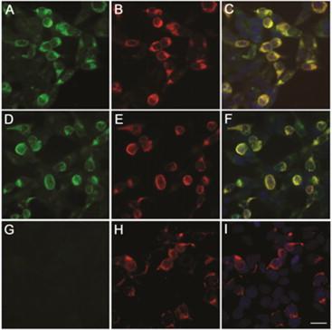 Figure 11.2, GlyRα1-IgG demonstrated in HEK293 cells expressing the human GlyRα1 subunit. The reactivity of serum from two representative patients with HEK293 cells expressing the human GlyRα1 subunit is shown in panels A and D . Serum from a control patient lacks reactivity with transfected cells ( G ). Panels B , E and H show the reactivity with a commercial GlyRα1 monoclonal antibody. Note that the immunostaining co-localizes with that of patient antibodies ( C and F , but not I ). Scale bar, 20 μm.