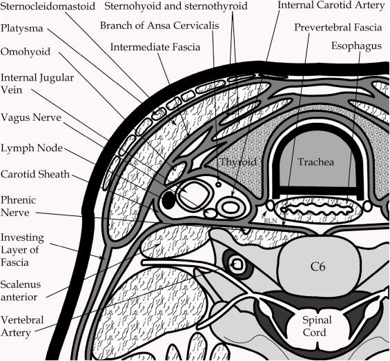 Figure 42.1, A diagram of the cross-sectional anatomy of the left neck at the level of C6 showing the relationship of the vagus nerve to the various muscles, fascial layers, and vascular structures. RNL , recurrent laryngeal nerve.