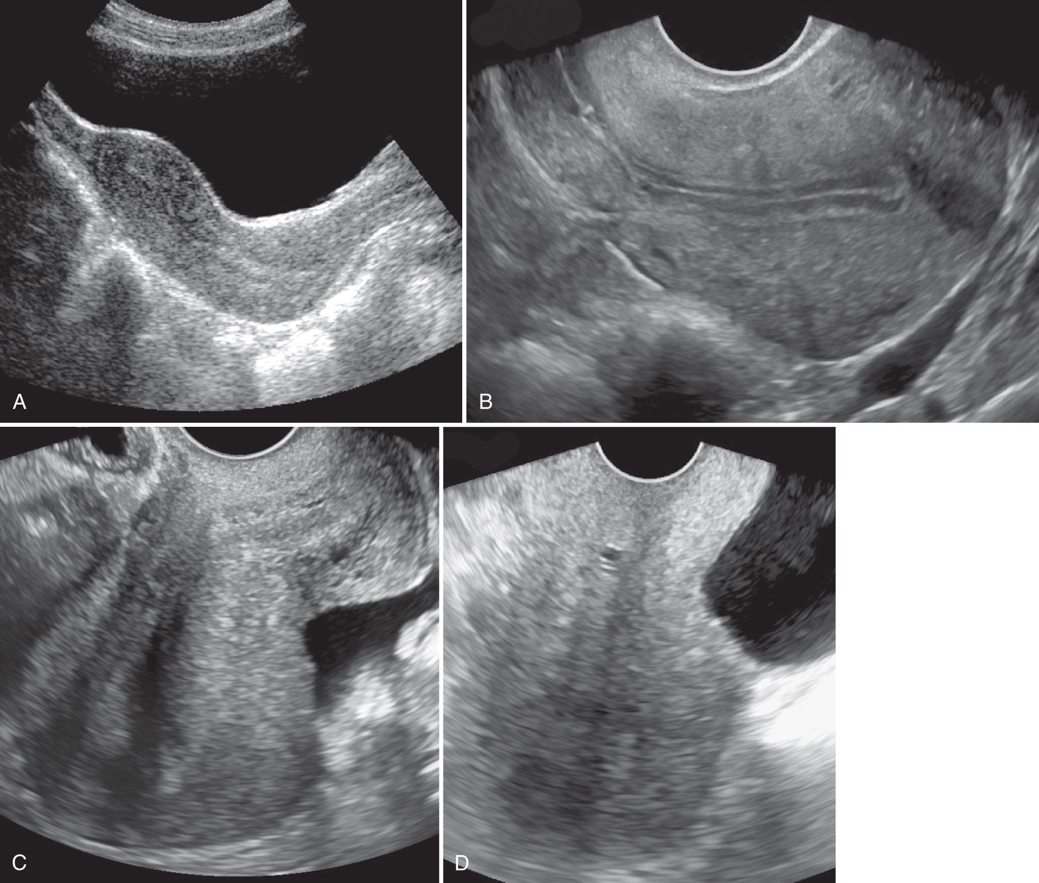 FIG. 15.2, Uterine Positions in the Sagittal Plane.