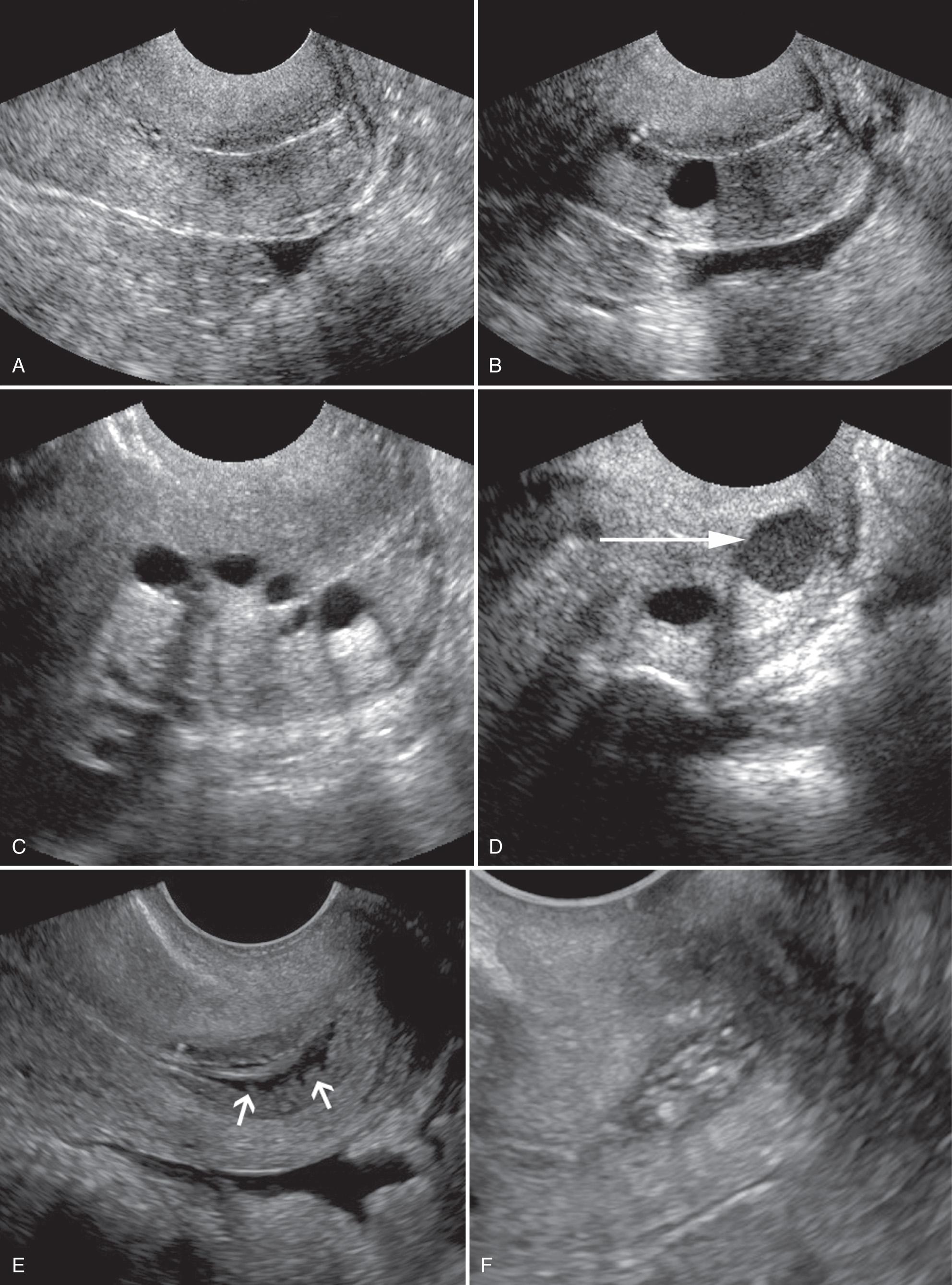 FIG. 15.7, Normal and Insignificant Cervical Findings.