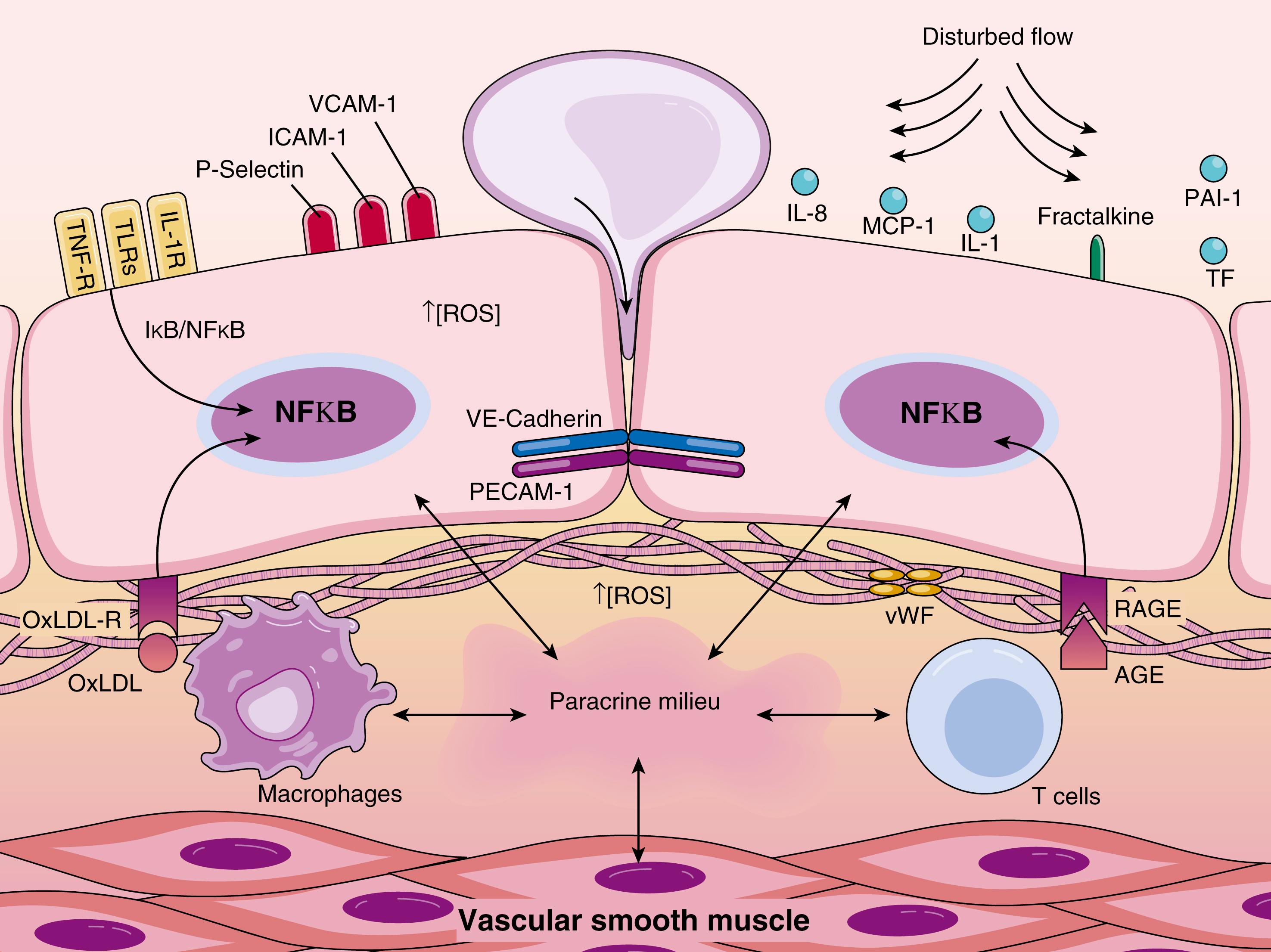 FIGURE 24.8, Endothelial proinflammatory activation. In lesion-prone regions of the arterial vasculature, the actions of proinflammatory agonists (e.g., interleukin [IL]-1, tumor necrosis factor [TNF], and endotoxin), oxidized lipoproteins (Ox-LDL) and advanced glycation end products (AGE), and biomechanical stimulation by disturbed blood flow, leads to endothelial activation. These biochemical and biomechanical stimuli signal predominantly via the pleiotropic transcription factor nuclear factor-κB (NF-κB), resulting in a coordinated program of genetic regulation within the endothelial cell. This includes the cell surface expression of adhesion molecules (e.g., vascular cell adhesion molecule-1 [VCAM-1]), secreted and membrane-associated chemokines (e.g., monocyte chemoattractant protein [MCP]-1 and fractalkine), and prothrombotic mediators (e.g., tissue factor [TF], von Willebrand Factor [vWF], and the inhibitor of fibrinolysis plasminogen activator inhibitor [PAI]-1). These events foster the selective recruitment of monocytes and various types of T lymphocytes, which become resident in the subendothelial space. The concerted actions of activated endothelial cells, smooth muscle cells, monocyte/macrophages, and lymphocytes result in the production of a complex paracrine milieu of cytokines, growth factors, and reactive oxygen species (ROS) within the vessel wall, which perpetuates a chronic proinflammatory state and fosters atherosclerotic lesion progression. IL-R, TNF-R indicates receptor(s) for IL-1, TNF; Ox-LDL-R, receptor for oxidized LDL; RAGE, receptor for AGE; TLRs, Toll-like receptors.