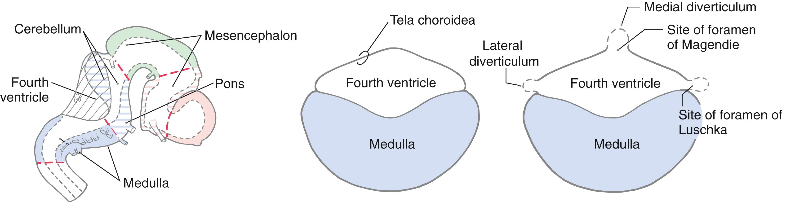 Fig. 6.2, Development of the foramina of Luschka and Magendie in the fourth ventricle.