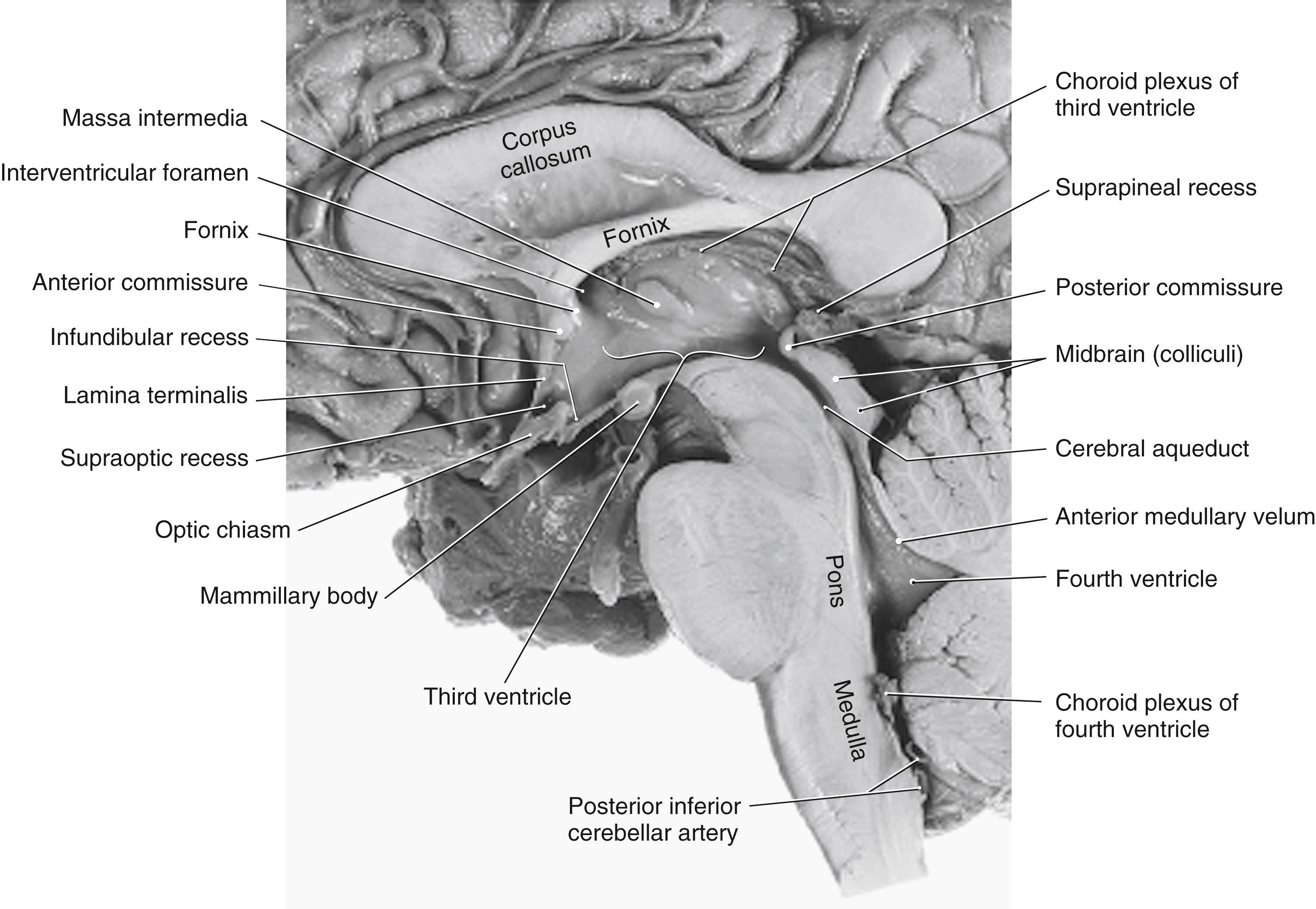 Fig. 6.8, Midsagittal view of the brain showing the third ventricle, cerebral aqueduct, and fourth ventricle and structures closely related to these spaces.