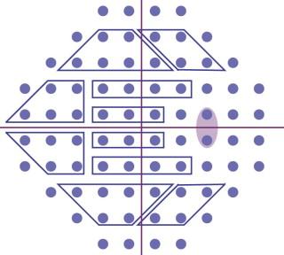 Figure 35.7, The clusters of visual field locations used to evaluate superior and inferior hemifield asymmetry as part of the glaucoma hemifield test. The clusters were selected to generally correspond to the pattern of nerve fiber bundles entering the optic nerve head.