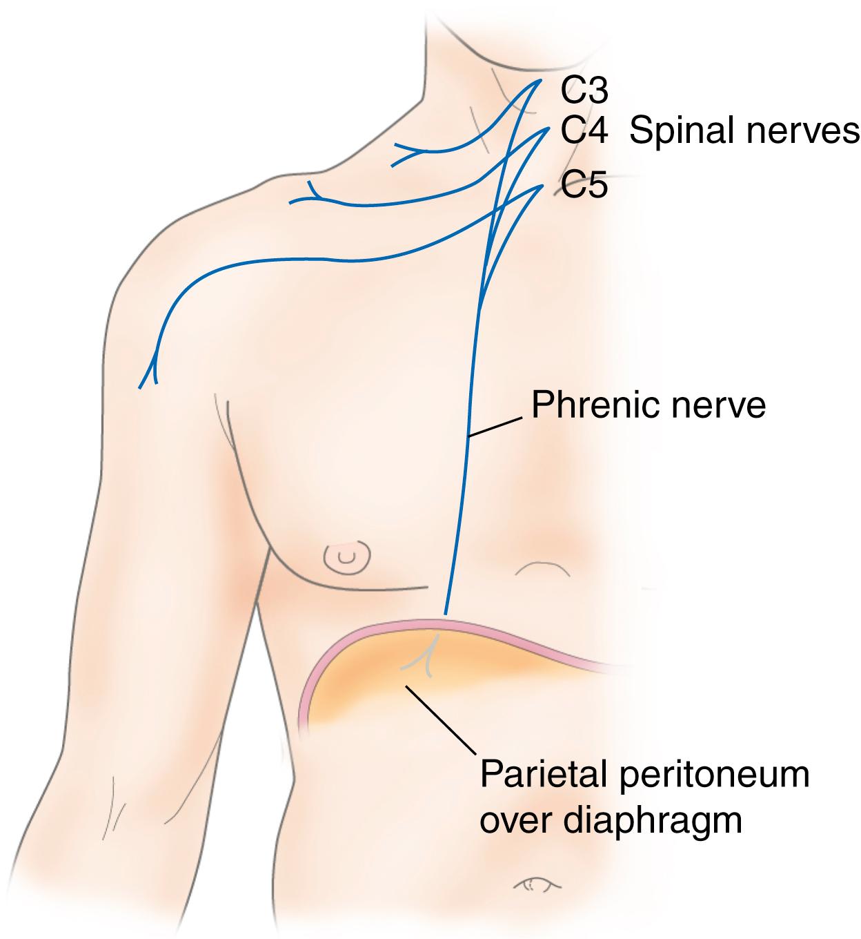 Fig. 13.1, The shared sensory innervation of the shoulder and diaphragm.