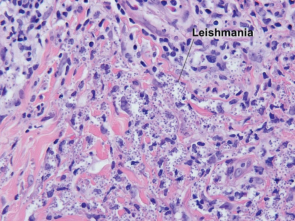 Fig. 1.22, Leishman–Donovan bodies, leishmaniasis