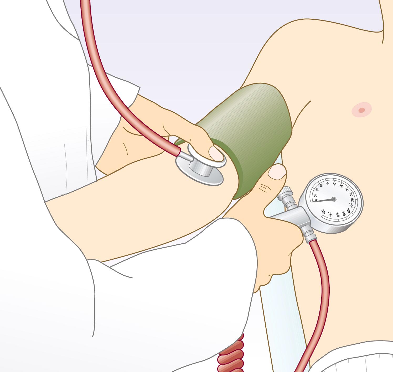 Fig. 4.12, Measuring the blood pressure.