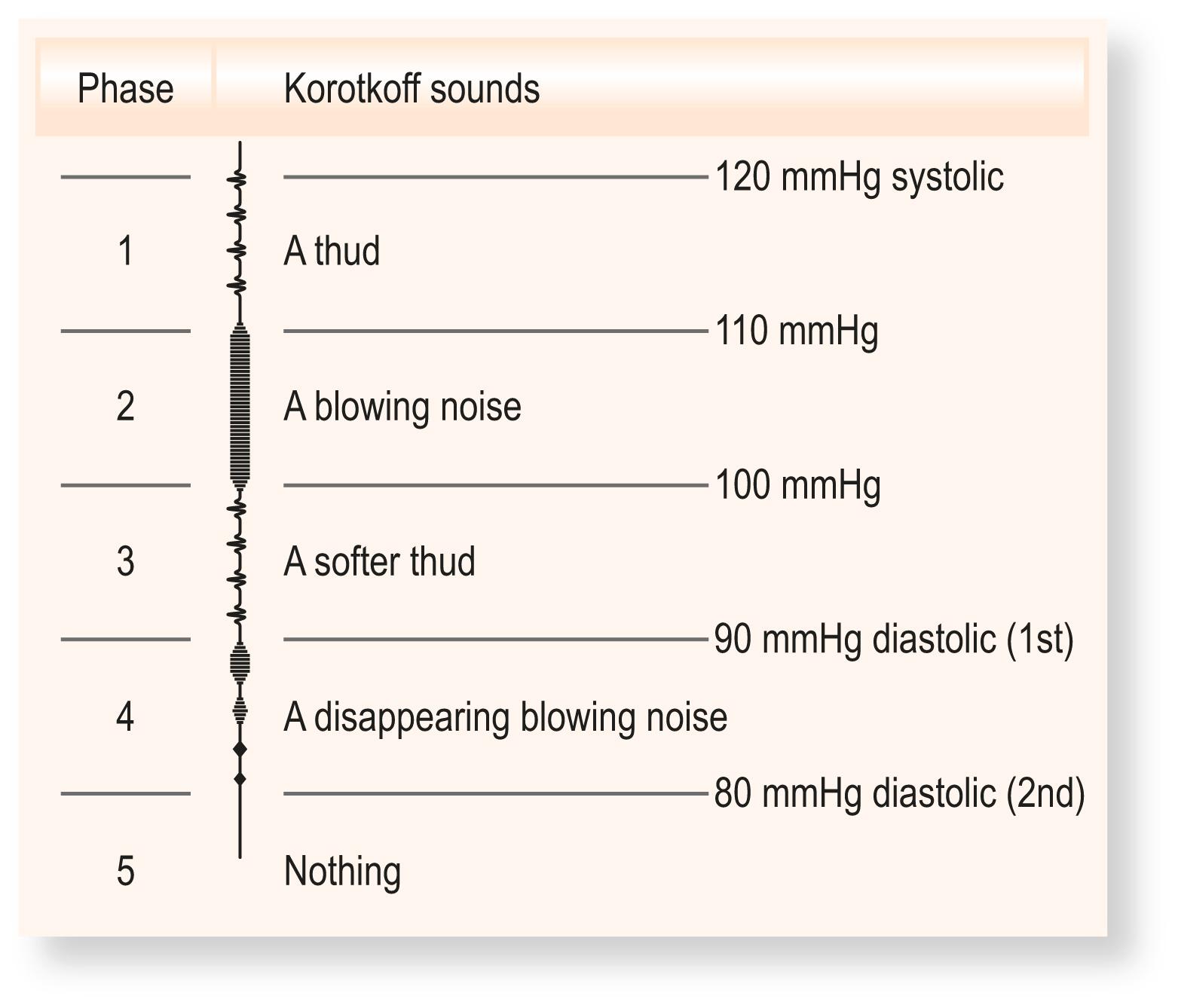 Fig. 4.13, Korotkoff sounds.