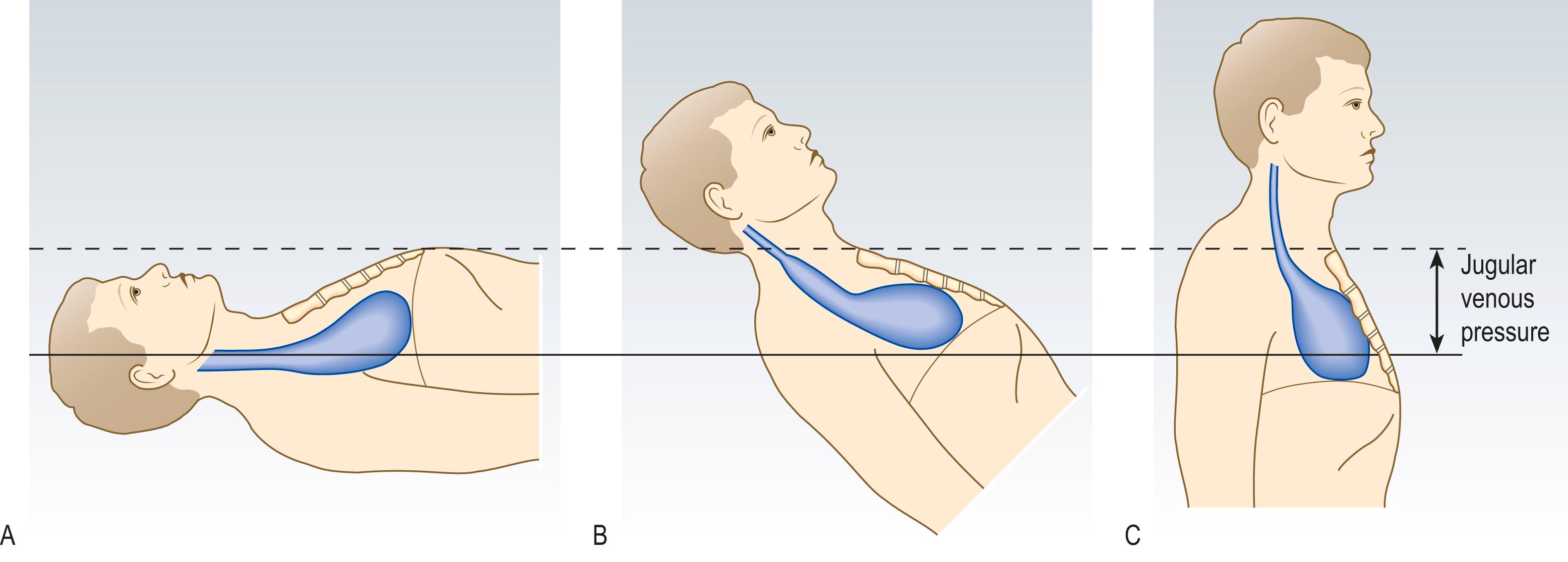 Fig. 4.14, Jugular venous pressure in a healthy subject.