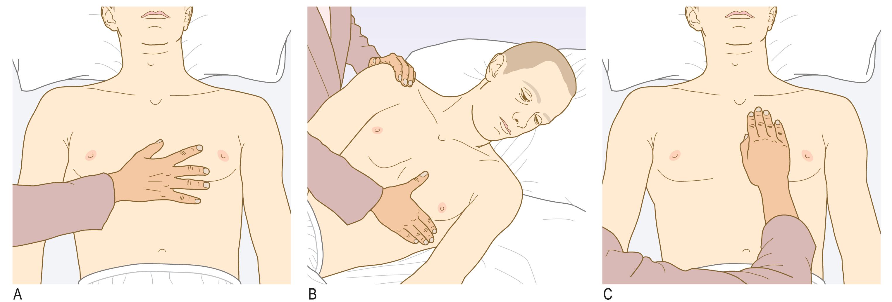 Fig. 4.17, Palpating the heart.