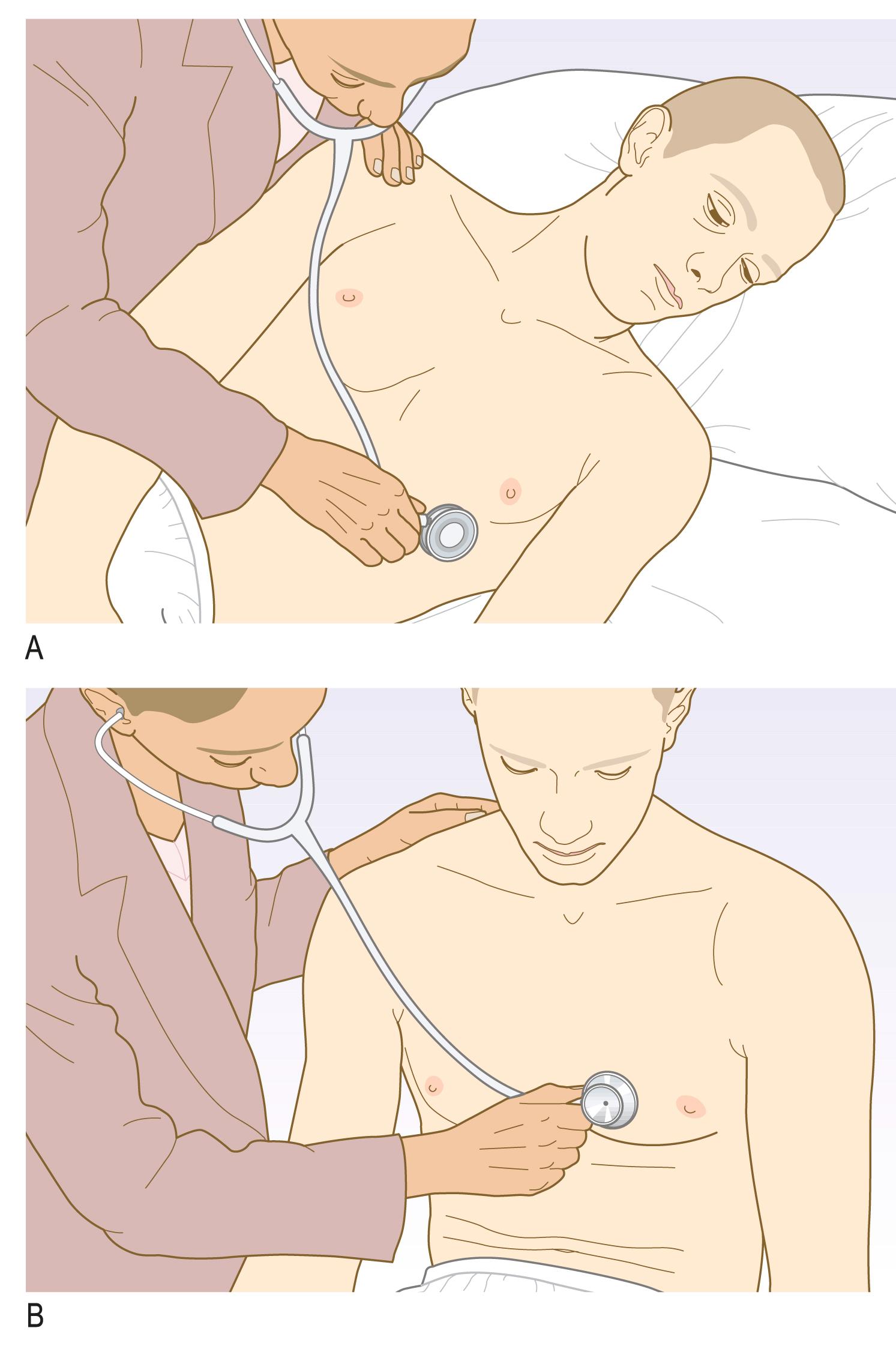 Fig. 4.18, Auscultating the heart.