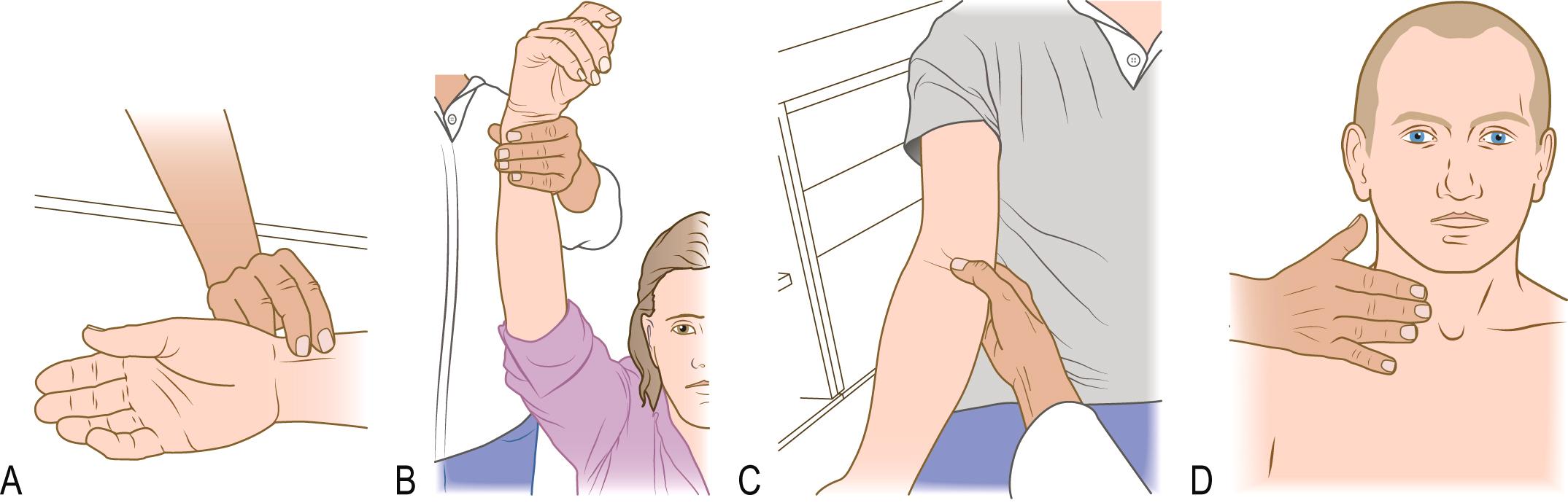 Fig. 4.7, The radial, brachial and carotid pulses.