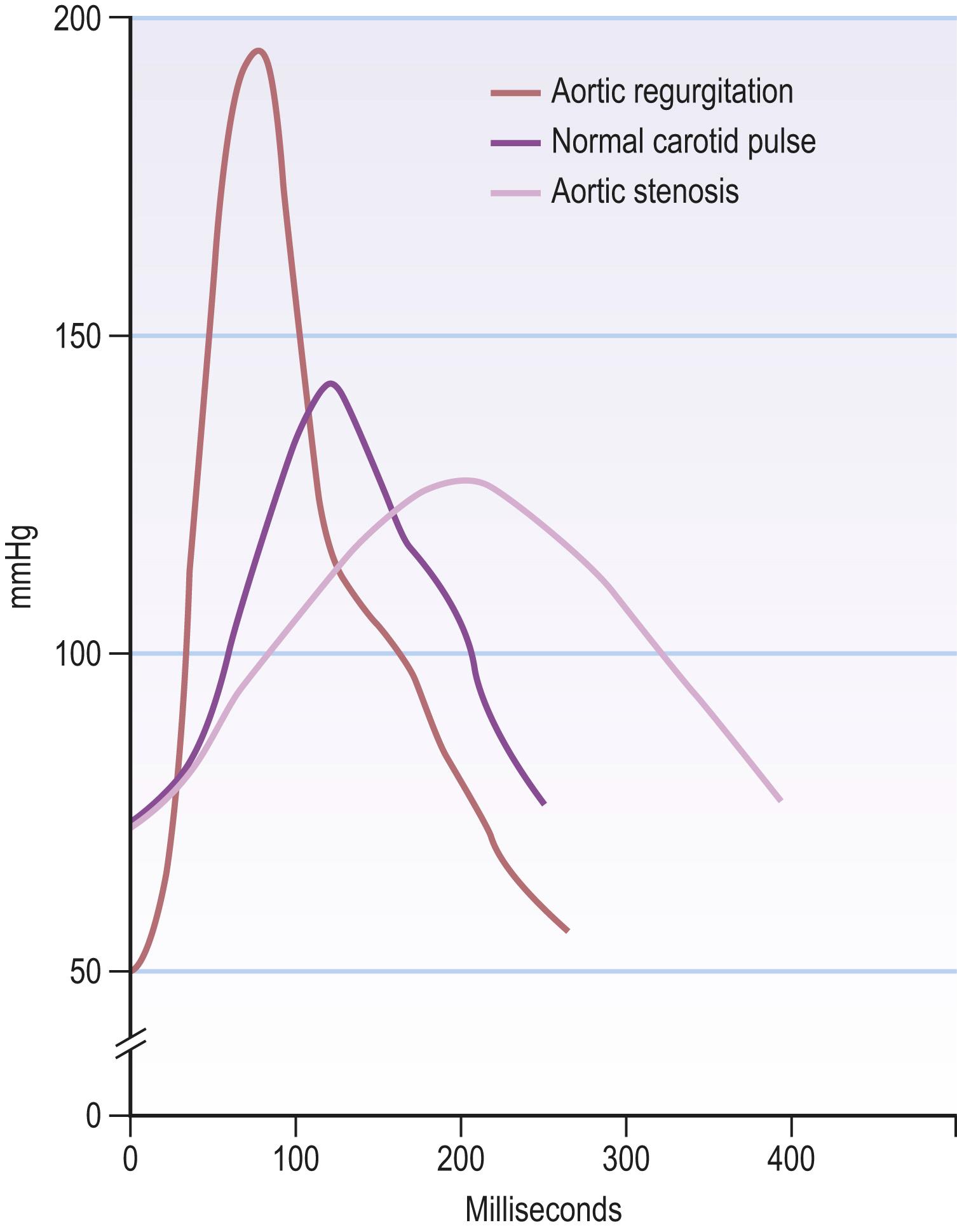 Fig. 4.10, Pulse waveforms.