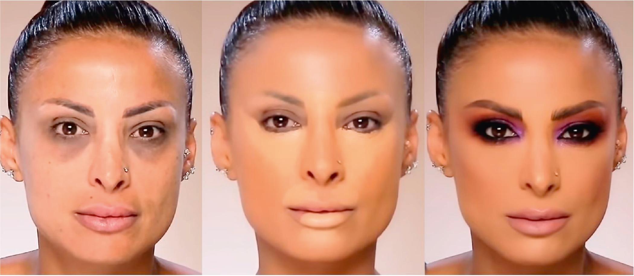 Fig. 44.5, In this example, yellow-orange concealer is used to neutralize the underlying dark pigmentation. Skin-toned concealer and foundation are then applied and blended. Makeup by Samer Khazoumi.