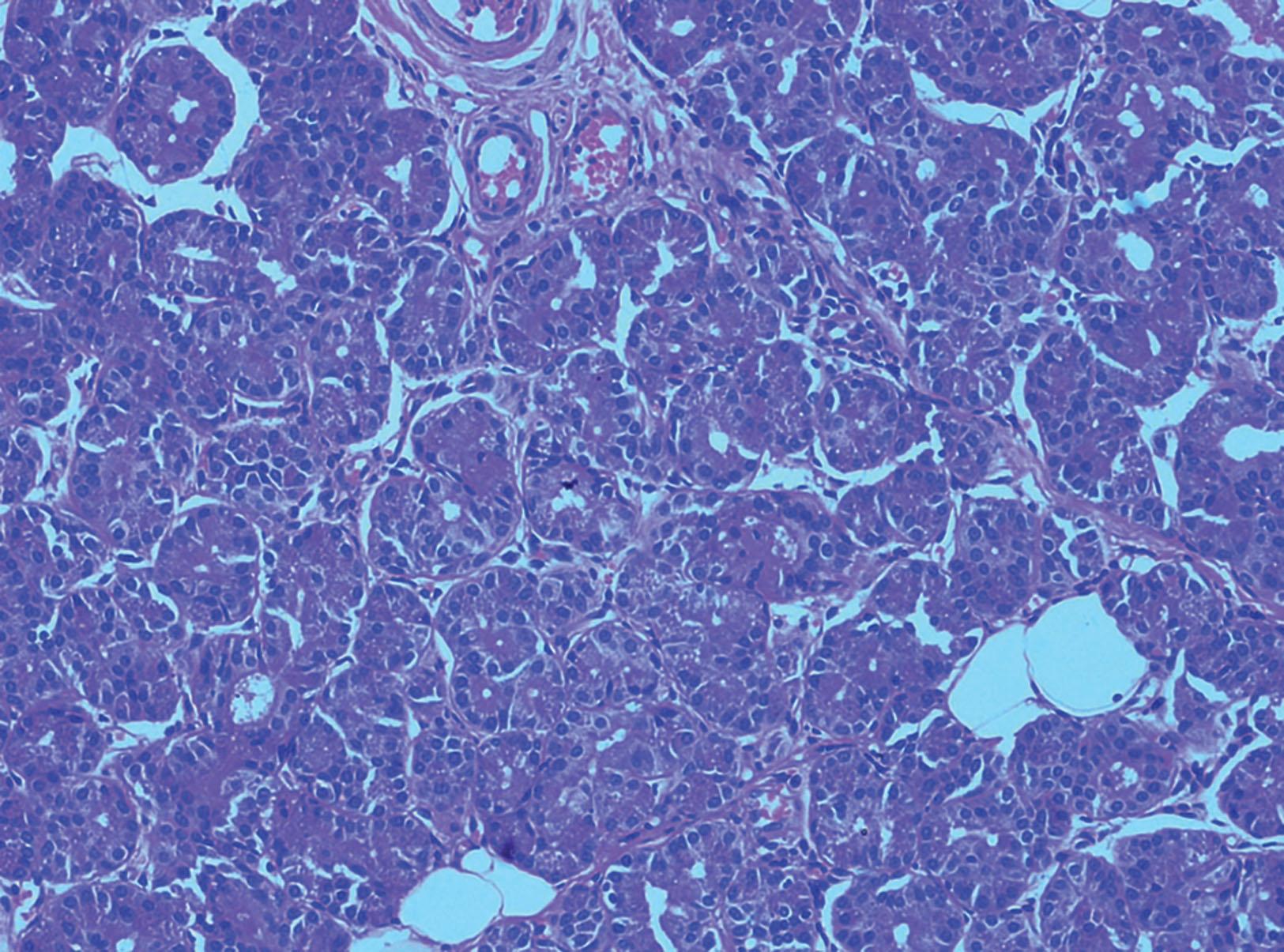 Fig. 18.1, Microphotograph showing the structure of a normal lacrimal gland with its acini and ducts.