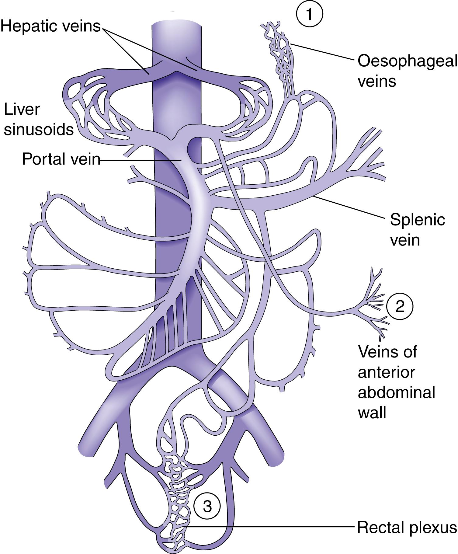 Fig.15.11, The portal venous system. Sites of portosystemic shunting are marked 1 to 3 . Retroperitoneal communications also exist.