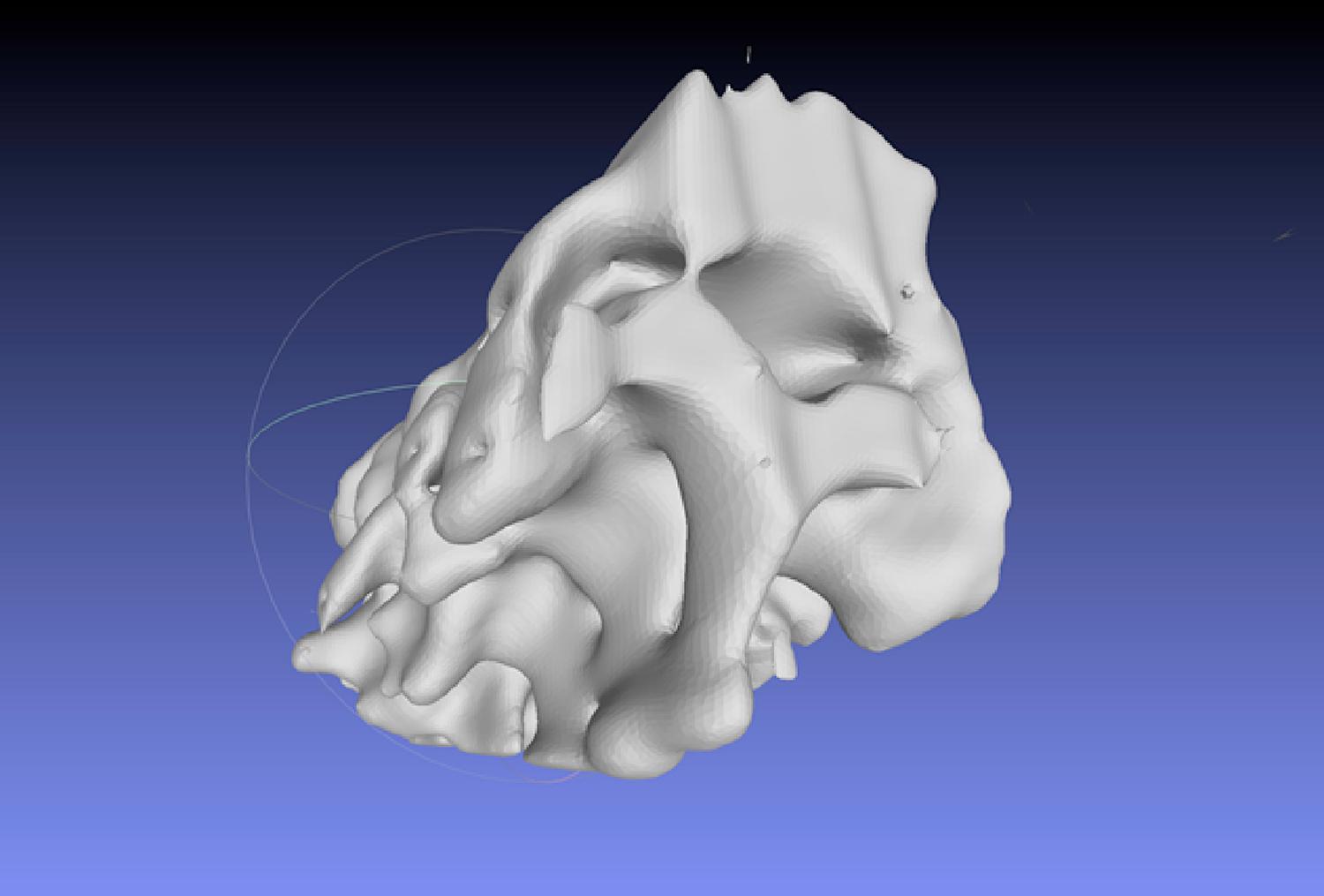 Figure 2.2, Derived 3D model from 3D Slicer ready to print.